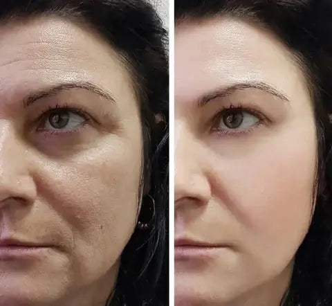 Crème magique FaceSlift® - dissimule 100% des imperfections et élimine les taches et les rides